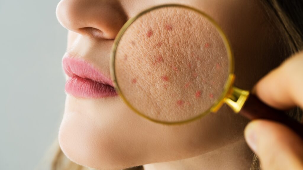 Skin Barrier by Karen at skinklareesthetics.com